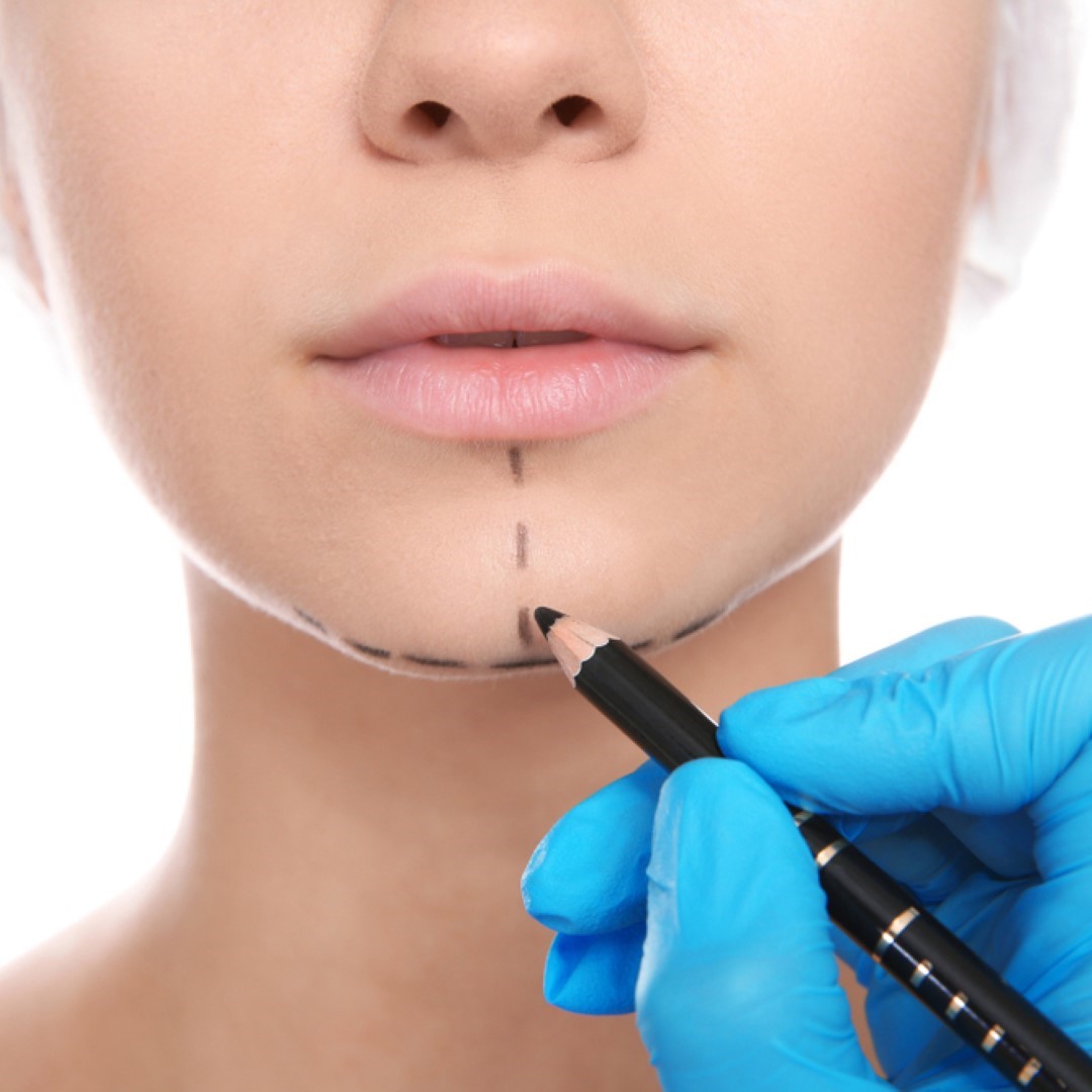 Chin Surgery
